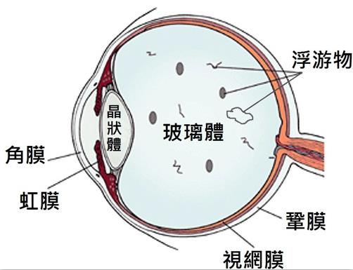 看東西有閃光感是什么原因造成