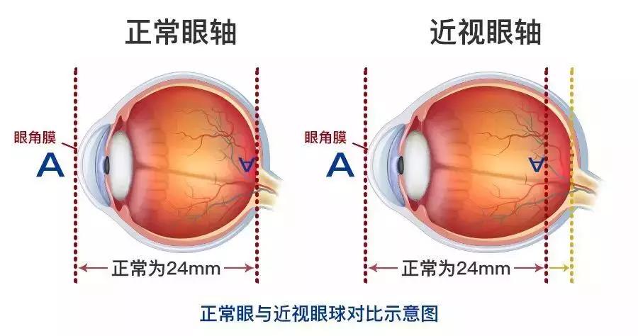 云南治療視網膜哪家眼科醫(yī)院好？