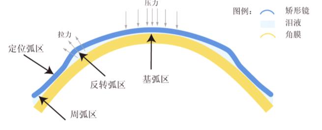 昆明哪里可以配OK鏡？