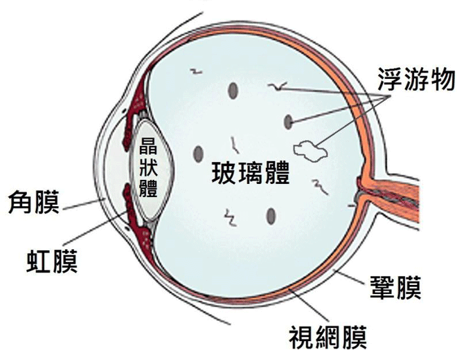 昆明眼底病治療